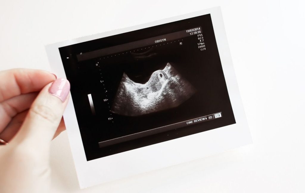 Detaylı - Ayrıntılı Ultrason Nedir?